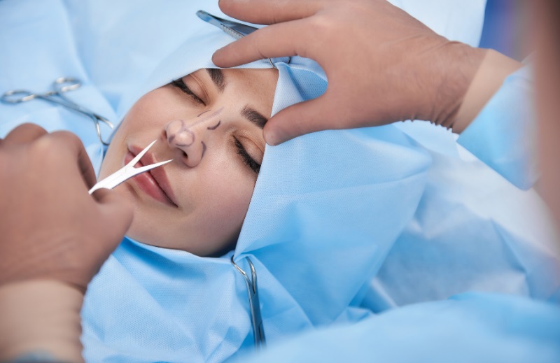 Rhinoplasty 3